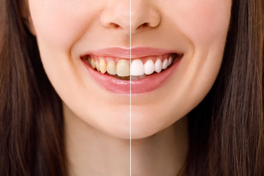 Cosmetic Dentistry